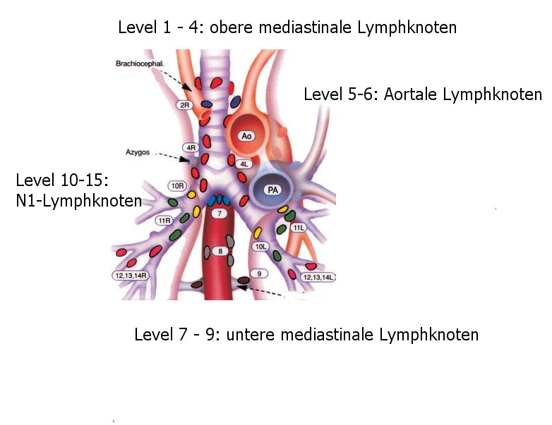 LK-Level