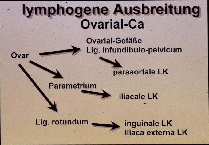 lymphogene Ausbreitung