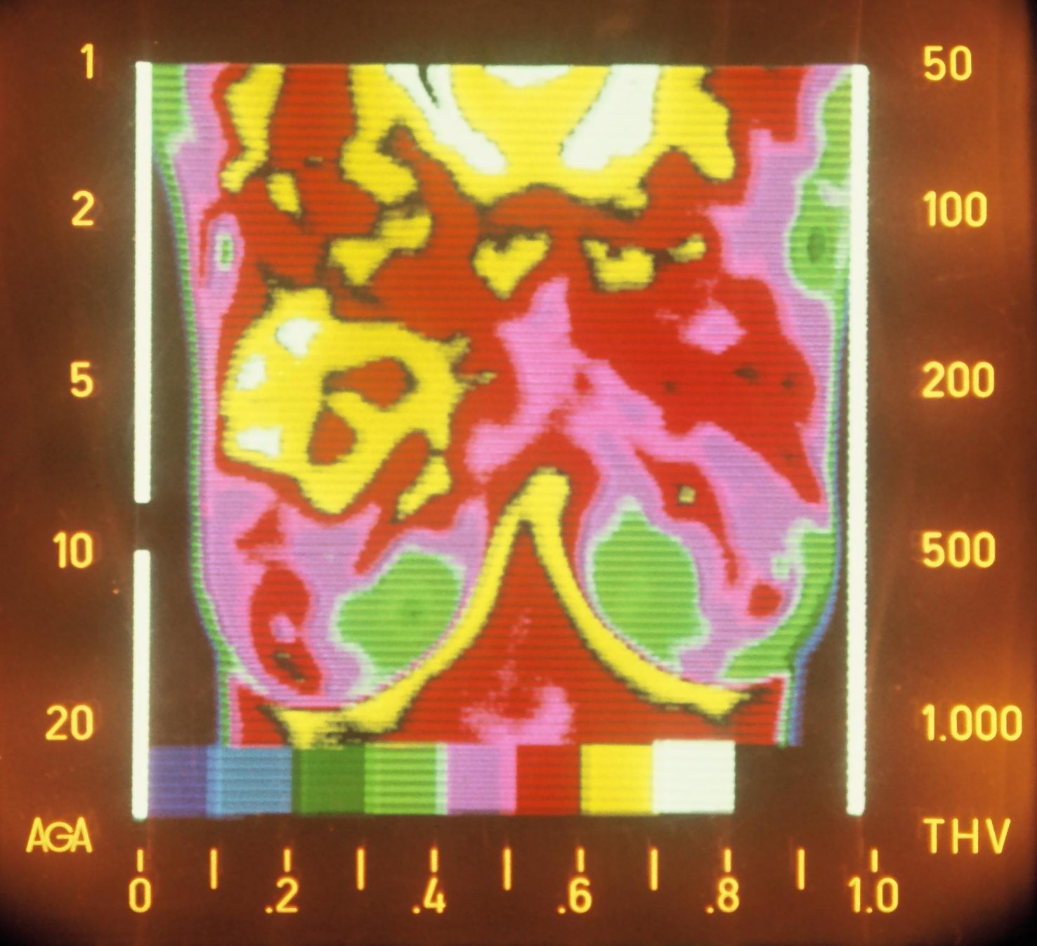 Thermographie