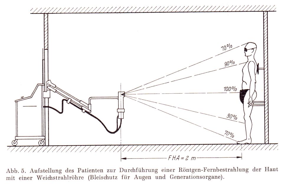 Ganzkrper-Weichstrahl-Behandlung