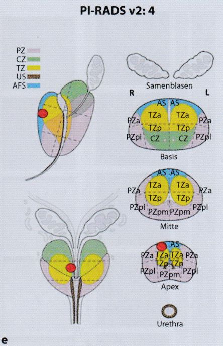 PI-RADS